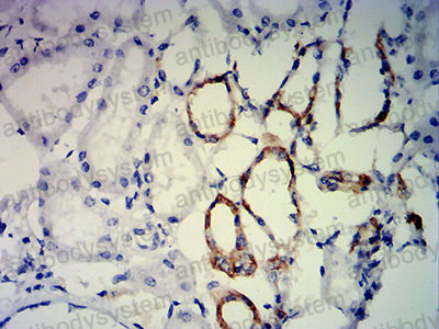 Валидация AntibodySystem RHC29305