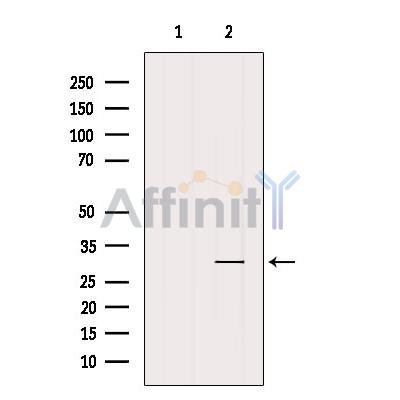 Валидация Affinity AF5136 - 2521