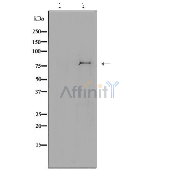 Валидация Affinity DF6598 - 18045