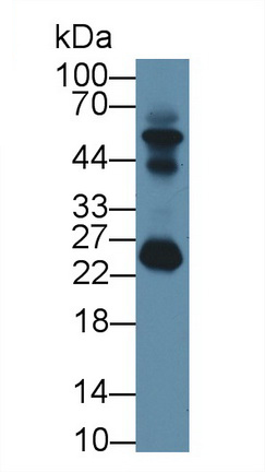 12766