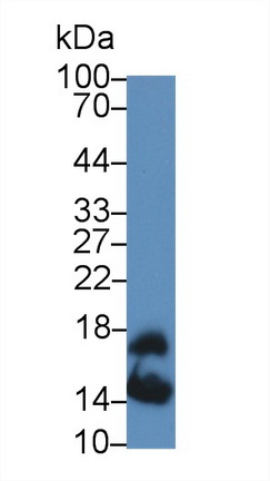 13851