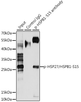 AP0040, иммунопреципитация, клетки HeLa (25780)