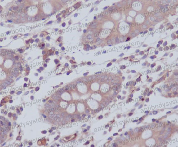 Валидация AntibodySystem RHN60601