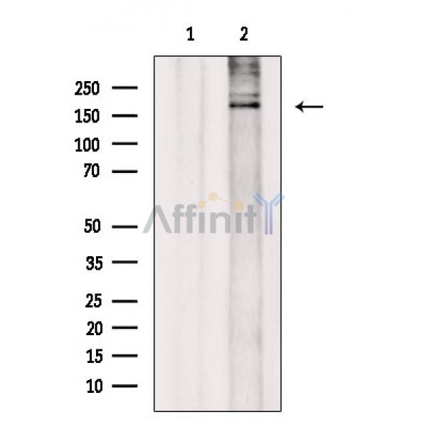 Валидация Affinity DF8509 - 20370