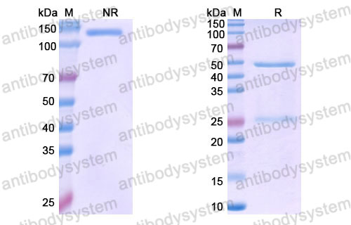 Валидация SDS-PAGE - AntibodySystem DHF92408