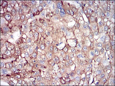 Валидация AntibodySystem RHC02401 (551)