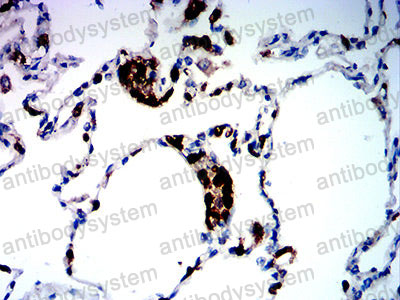 Валидация AntibodySystem RHH08902 (3167)