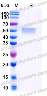 EHJ64902, SDS-PAGE