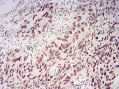 Валидация AntibodySystem RHF75403 (2651)