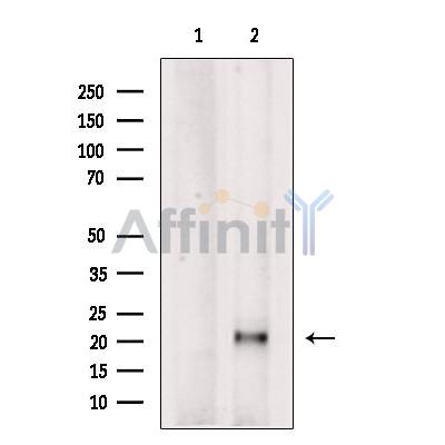 Валидация Affinity DF6532 - 17955