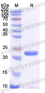 YVV01703, SDS-PAGE