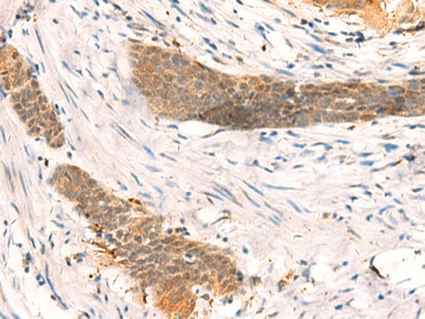 Валидация Elabscience E-AB-52002