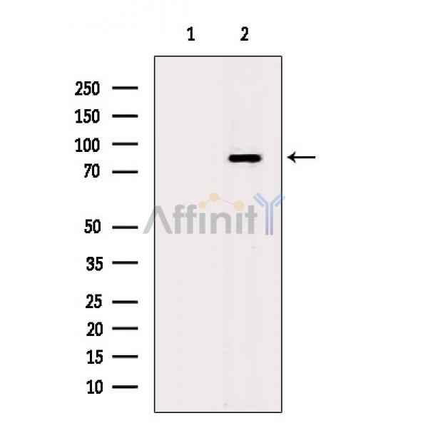 Валидация Affinity DF8607 - 20527