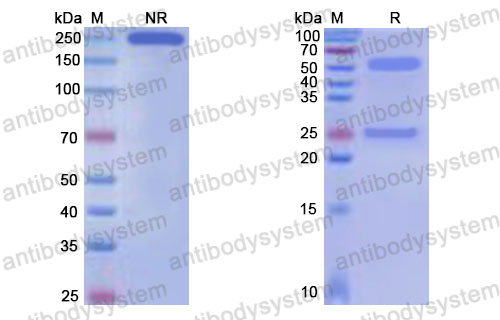 Валидация SDS-PAGE - AntibodySystem DHD17226