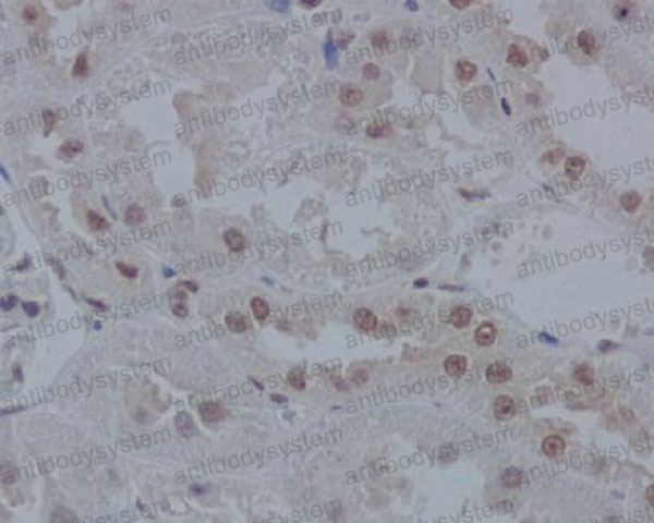 Валидация AntibodySystem RHC84401