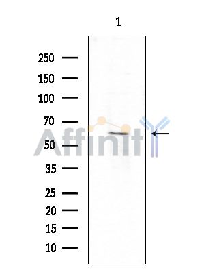 Валидация Affinity DF15255 - 11535
