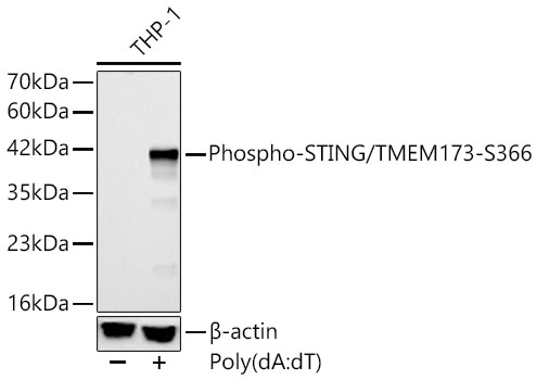 AP1223, вестерн-блоттинг, лизат клеток THP-1 (18620)