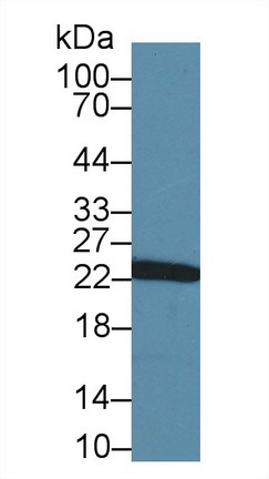 8555
