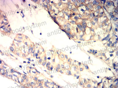 Валидация AntibodySystem RHD08208 (1323)