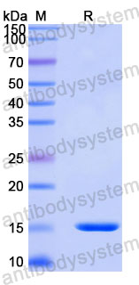 Валидация SDS-PAGE - AntibodySystem RMJ70102