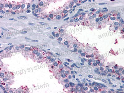 Валидация AntibodySystem RHF93201 (2734)