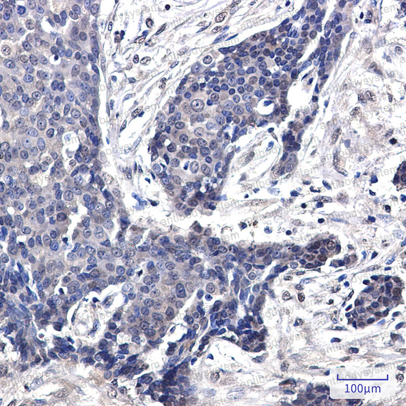 Валидация AntibodySystem RHG62701