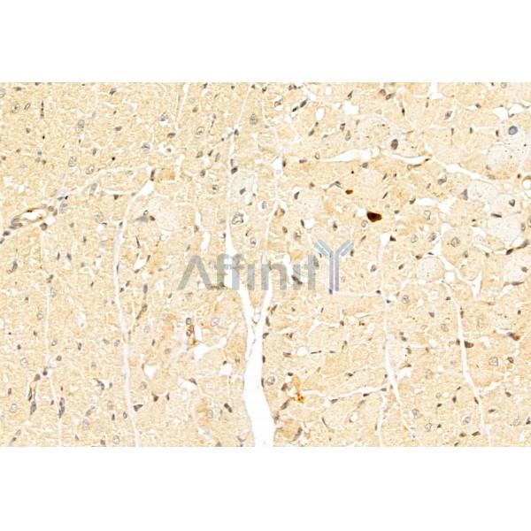 Валидация Affinity DF6033 - 17253