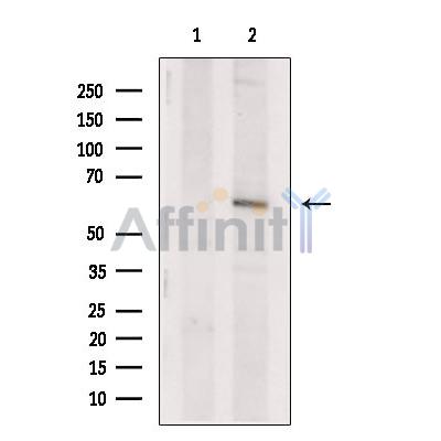 Валидация Affinity DF6676 - 18164