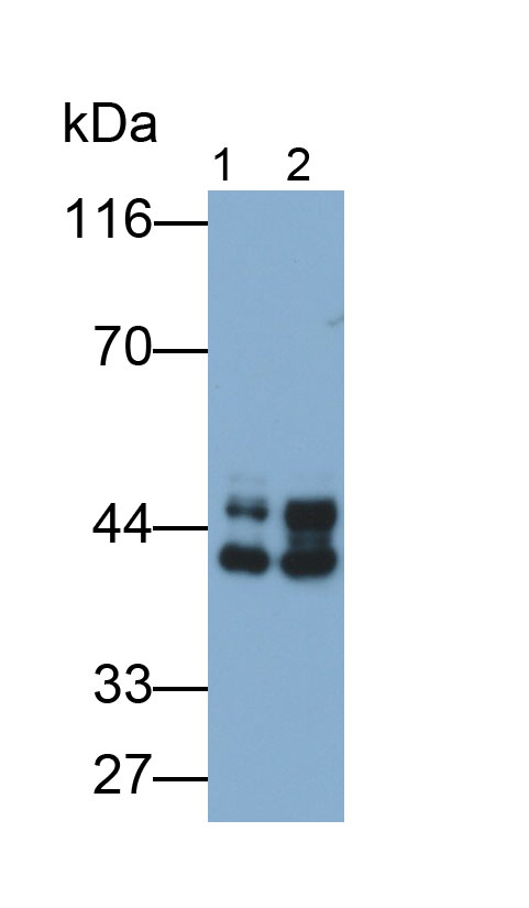 31665