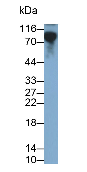 30690