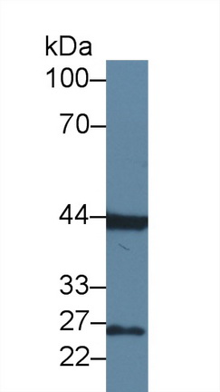 12411