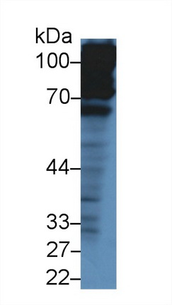 13854