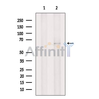 Валидация Affinity DF6498 - 17897