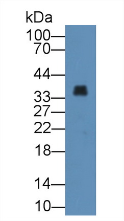 12355