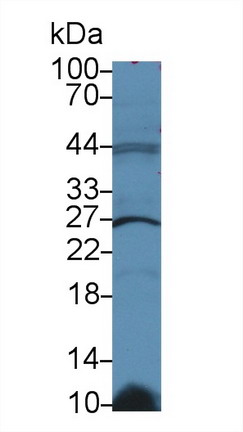 9723
