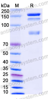 EHC21902, SDS-PAGE