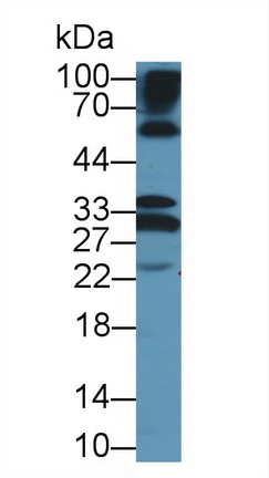 12677