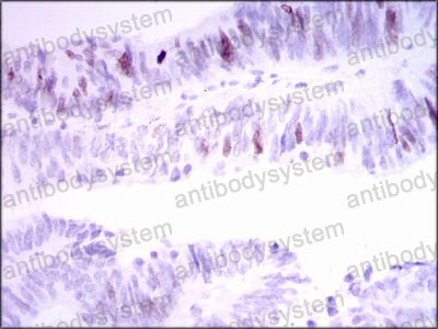 Валидация AntibodySystem RHN93001