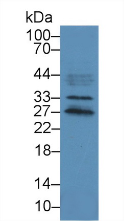12864