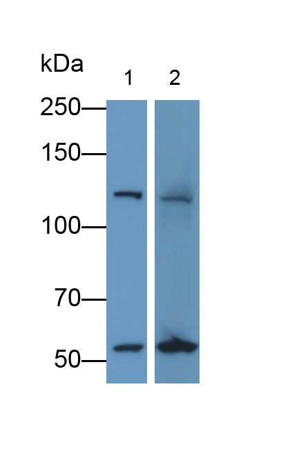 31385
