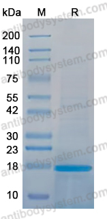 YVV45303, SDS-PAGE
