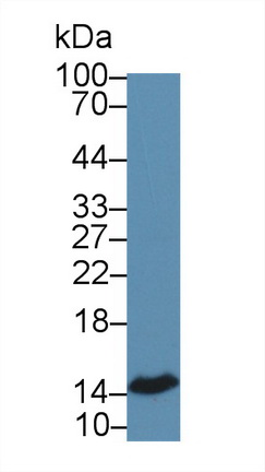 12418