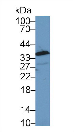 9178