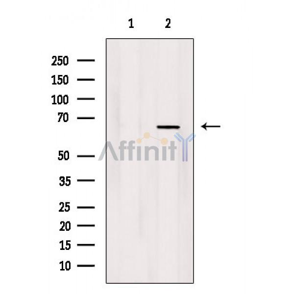 Валидация Affinity AF3795 - 2045