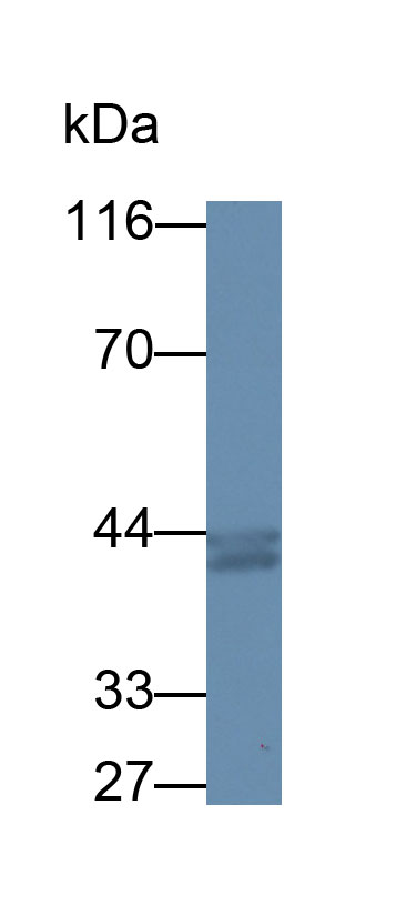 65135