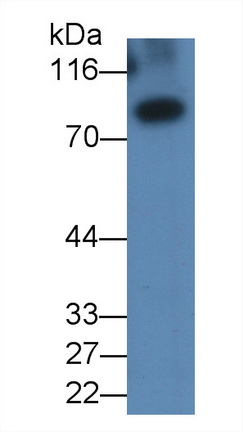 23920