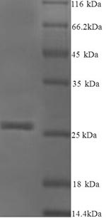 SDS-PAGE