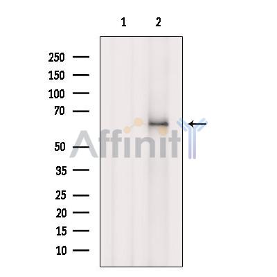 Валидация Affinity DF9147 - 21490
