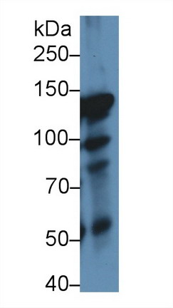 9744