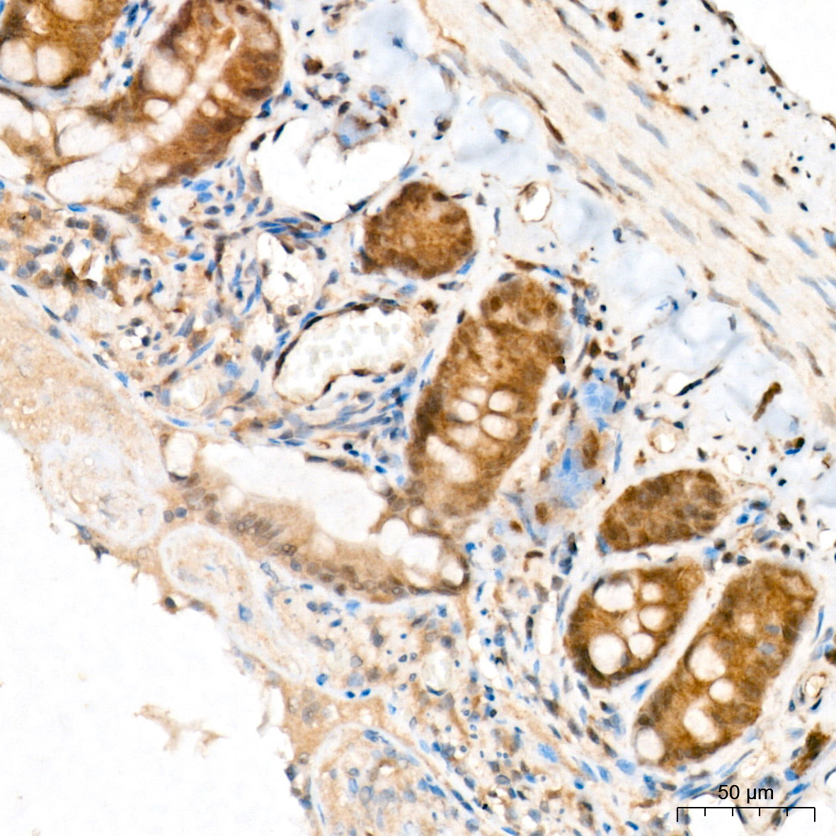 AP1394, иммуногистохимия, ткань толстой кишки крысы (19174)